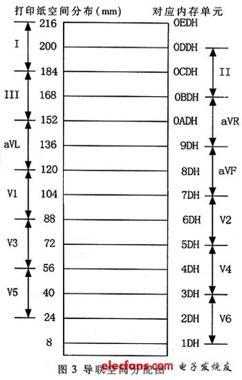 為各個(gè)導(dǎo)聯(lián)分配的熱敏打印紙空間與緩沖內(nèi)存單元