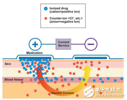 另一種基于MCU的給藥設(shè)備