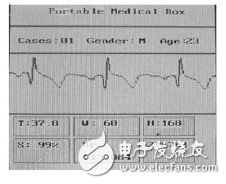  基于STM32的便攜體檢裝置的設(shè)計(jì)與實(shí)現(xiàn)