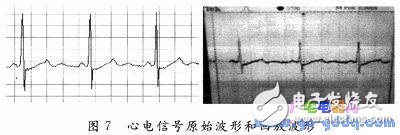 BIH心電數(shù)據(jù)D／A回放設(shè)計