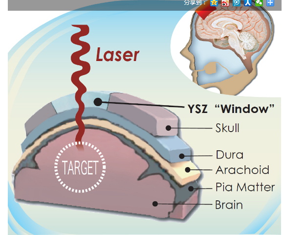 為頭骨打造出“可視窗戶(hù)”技術(shù)出爐，對(duì)大腦的監(jiān)測(cè)更加高效