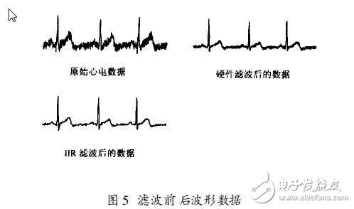 DIY自己的家庭電子醫(yī)療箱 軟硬件設(shè)計(jì)方案 （二）前置放大和抗干擾